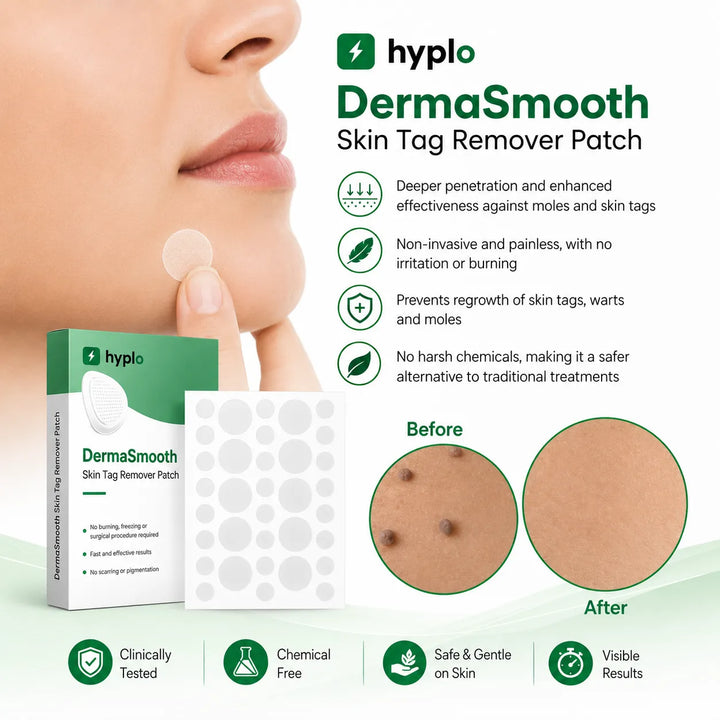 Gentle Skin Tag Patches – Soft Daily-Wear Patches for Smoother-Looking Skin