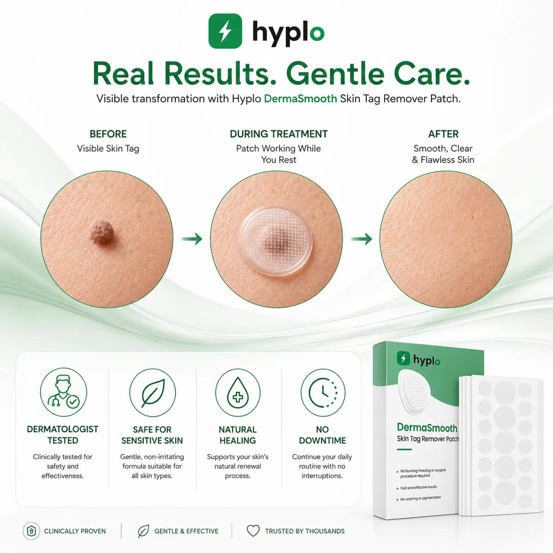 Gentle Skin Tag Patches – Soft Daily-Wear Patches for Smoother-Looking Skin