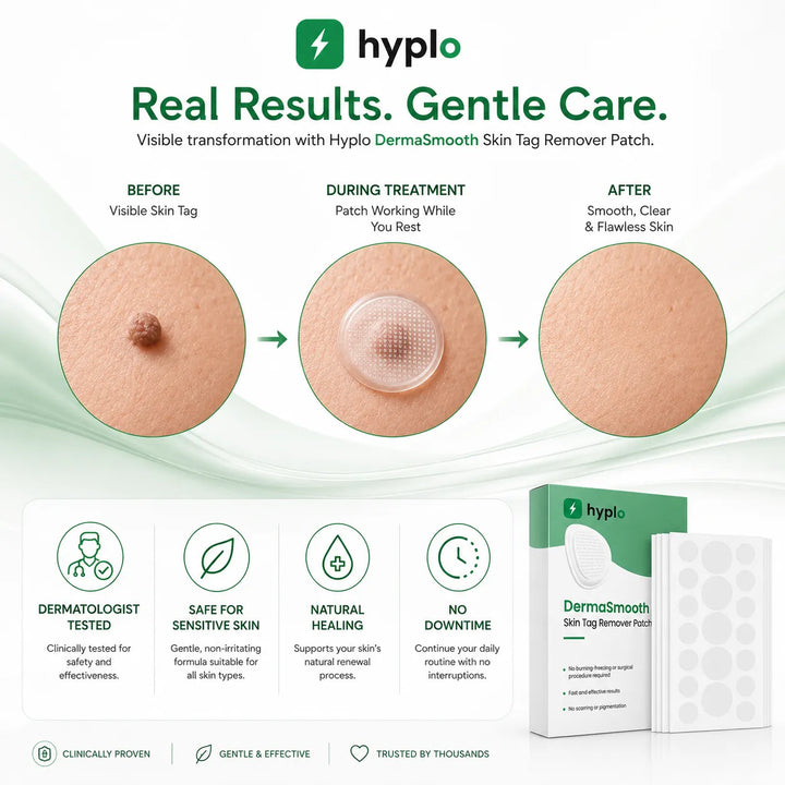 Gentle Skin Tag Patches – Soft Daily-Wear Patches for Smoother-Looking Skin