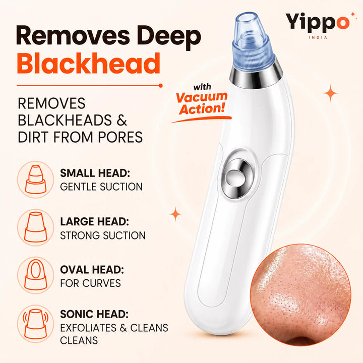 DermaSuction 4-in-1 Pore Vacuum & Blackhead Remover